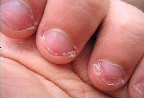 成人咬指甲视频大全集,视频大全集深度解析