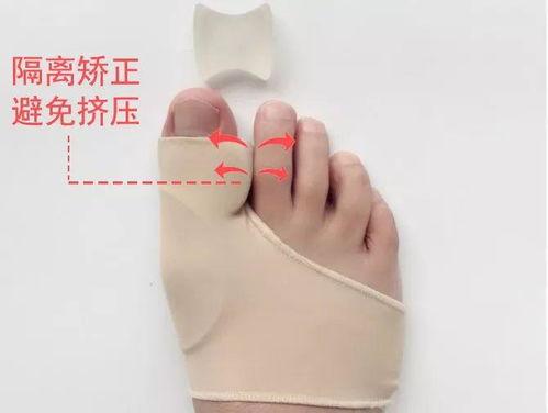 成人拐脚矫正方法视频,跟随视频教程，重拾稳健步伐  第2张